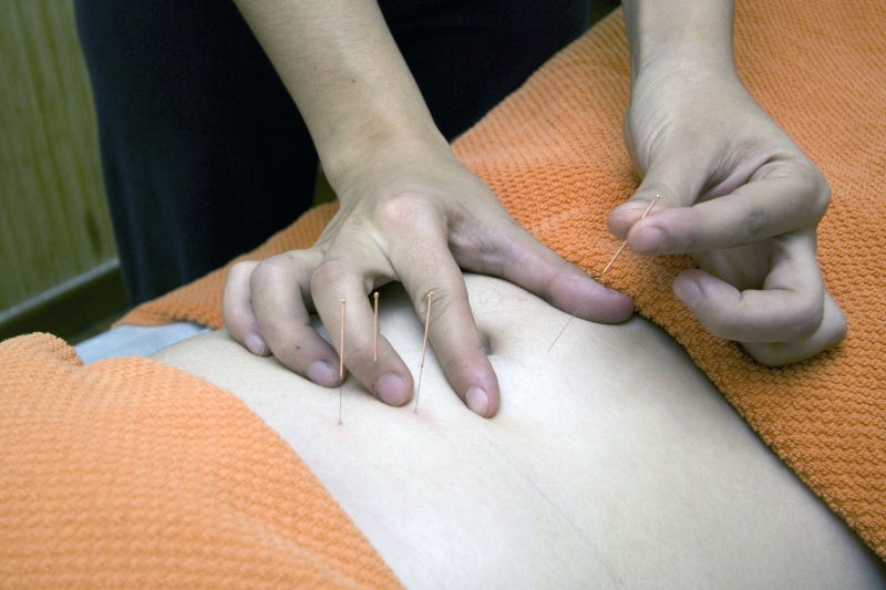 osteopathe-BARGEME-min_acupuncture-4175625